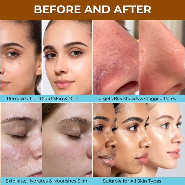 Walnut Face Scrub for Glowing Skin - 100g
