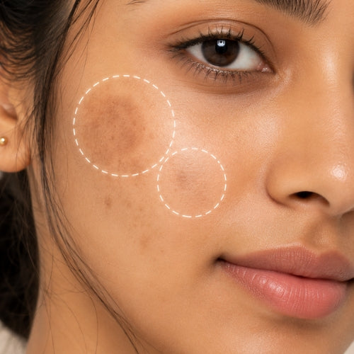Corrects Uneven Skin Tone
